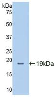 Polyclonal Antibody to Intercellular Adhesion Molecule 1 (ICAM1)