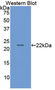 Polyclonal Antibody to Matrix Metalloproteinase 9 (MMP9)