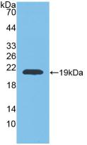 Polyclonal Antibody to Matrix Metalloproteinase 9 (MMP9)