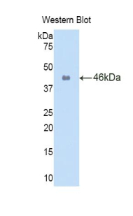 Polyclonal Antibody to Interleukin 1 Beta (IL1b)