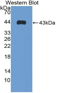 Polyclonal Antibody to S100 Calcium Binding Protein B (S100B)