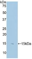 Polyclonal Antibody to S100 Calcium Binding Protein B (S100B)