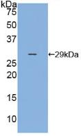 Polyclonal Antibody to P-Selectin (SELP)