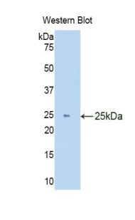 Polyclonal Antibody to Heme Oxygenase 1 (HO1)