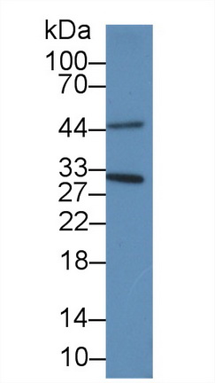 Polyclonal Antibody to Proliferating Cell Nuclear Antigen (PCNA)