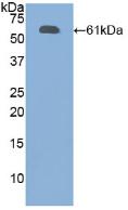 Polyclonal Antibody to Fibrillin 1 (FBN1)