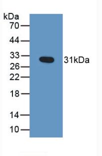 Polyclonal Antibody to Granzyme B (GZMB)