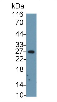 Polyclonal Antibody to Granzyme B (GZMB)