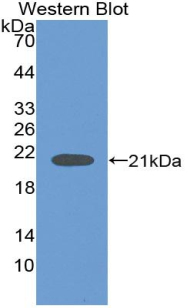 Polyclonal Antibody to Neuroglobin (NGB)