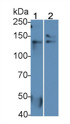 Polyclonal Antibody to Thrombospondin 1 (THBS1)