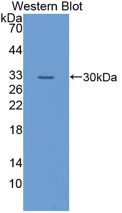 Polyclonal Antibody to Glutathione S Transferase Theta 1 (GSTt1)