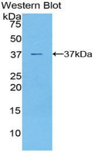 Polyclonal Antibody to Glycogen Synthase Kinase 3 Alpha (GSK3a)