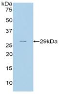 Polyclonal Antibody to Complement Factor H (CFH)