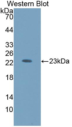 Polyclonal Antibody to Hexosaminidase B Beta (HEXb)