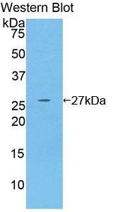 Polyclonal Antibody to Glutathione S Transferase Mu 4 (GSTm4)