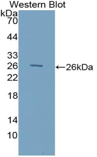 FITC-Linked Polyclonal Antibody to Glutathione S Transferase Mu 1 (GSTM1)