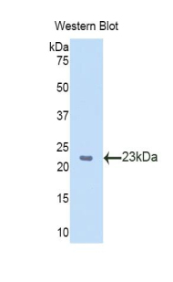 Polyclonal Antibody to Slit Homolog 2 (Slit2)