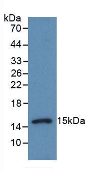 Polyclonal Antibody to Procalcitonin (PCT)