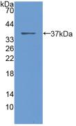 Polyclonal Antibody to Procalcitonin (PCT)