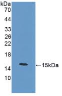 Polyclonal Antibody to Procalcitonin (PCT)