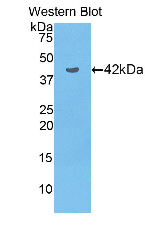 Polyclonal Antibody to Neuropilin 1 (NRP1)