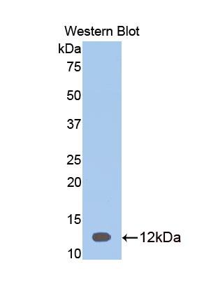 Polyclonal Antibody to Visceral Adipose Tissue Derived Serine Protease Inhibitor (Vaspin)