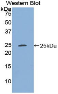 Polyclonal Antibody to Stromal Cell Derived Factor 4 (SDF4)