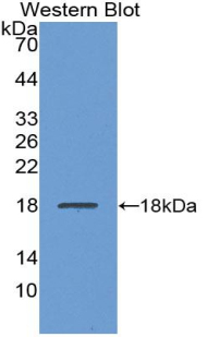 Polyclonal Antibody to Prealbumin (PALB)