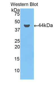 Polyclonal Antibody to Complement Component 7 (C7)