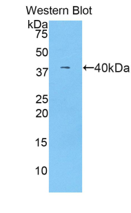 Polyclonal Antibody to Complement Component 7 (C7)