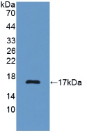 Polyclonal Antibody to Complement Component 7 (C7)