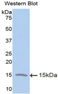 Polyclonal Antibody to Trefoil Factor 2 (TFF2)