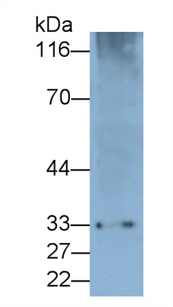 Polyclonal Antibody to Programmed Cell Death Protein 1 (PD1)