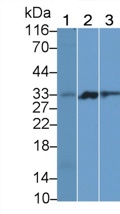 Polyclonal Antibody to Programmed Cell Death Protein 1 (PD1)