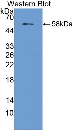 Polyclonal Antibody to Lipase, Hepatic (LIPC)