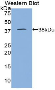 Polyclonal Antibody to Lactoferrin (LTF)