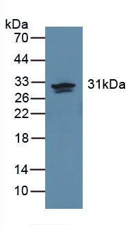 Polyclonal Antibody to Carbonic Anhydrase II (CA2)