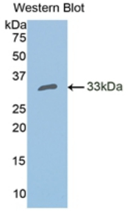 Polyclonal Antibody to Carbonic Anhydrase II (CA2)