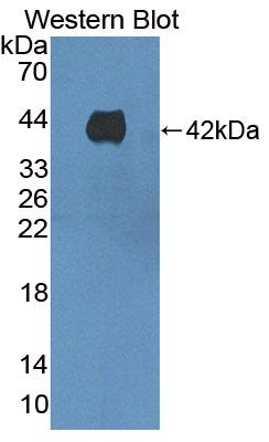 Polyclonal Antibody to Kidney Injury Molecule 1 (Kim1)