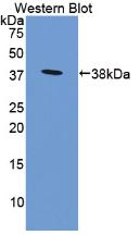 Polyclonal Antibody to Programmed Cell Death Protein 1 Ligand 1 (PDL1)