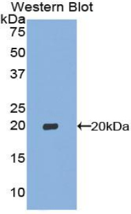 Polyclonal Antibody to Cyclin Dependent Kinase Inhibitor 2A (CDKN2A)