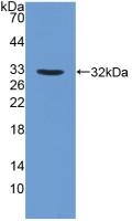 Polyclonal Antibody to Fucosidase Alpha L1, Tissue (FUCa1)