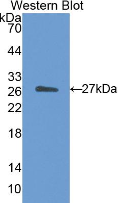 Polyclonal Antibody to Cholesteryl Ester Transfer Protein (CETP)