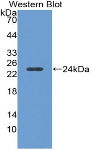 Polyclonal Antibody to Alpha-1-Acid Glycoprotein (a1AGP)