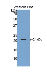 Polyclonal Antibody to Alpha-1-Acid Glycoprotein (a1AGP)