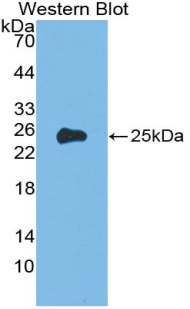 Polyclonal Antibody to Alpha-1-Acid Glycoprotein (a1AGP)