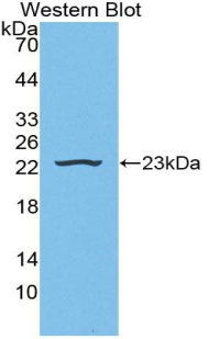 Polyclonal Antibody to Haptoglobin (Hpt)