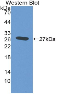 Polyclonal Antibody to C Reactive Protein (CRP)