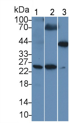 PAA821Eq01.jpg