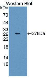 Polyclonal Antibody to C Reactive Protein (CRP)